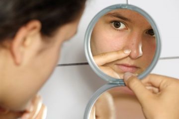 Acne: conheça os alimentos que ajudam na prevenção