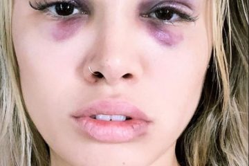 Sororidade: caso de agressão mobiliza mulheres de Itabira contra a violência 