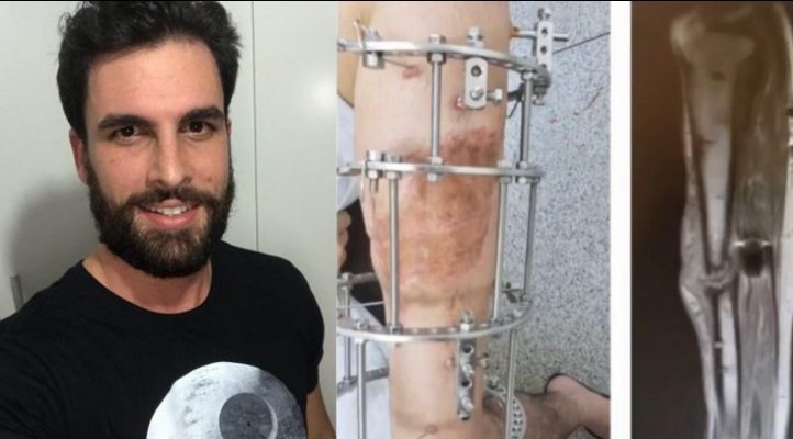 Cirurgia de urgência pode salvar a pena do rapaz de 27 anos