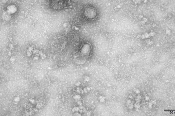 Grécia anuncia primeiro caso do novo coronavírus