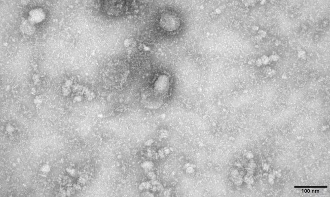 grecia-anuncia-primeiro-caso-do-novo-coronavirus