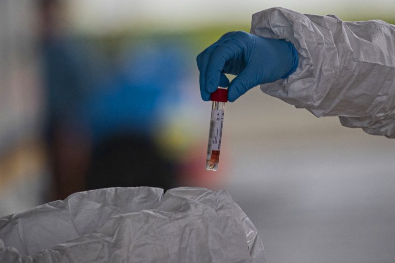 Vale diz que distribuição de testes ficará a cargo do governo federal