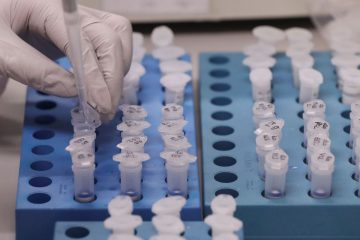 Monlevade tem 103 casos suspeitos de coronavírus e aguarda resultado de 25 exames