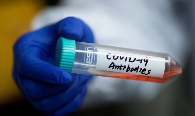 mais-27-casos-de-coronavirus-confirmados-em-itabira-nas-ultimas-24-horas