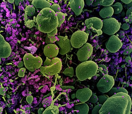 itabira-registra-mais-27-confirmacoes-e-chega-a-167-casos-de-coronavirus