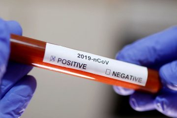 Brasil registra 929 óbitos por Covid em 24h, maior número desde 19/8