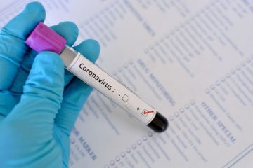 Boletim epidemiológico: 107 novos casos e dois óbitos em Itabira