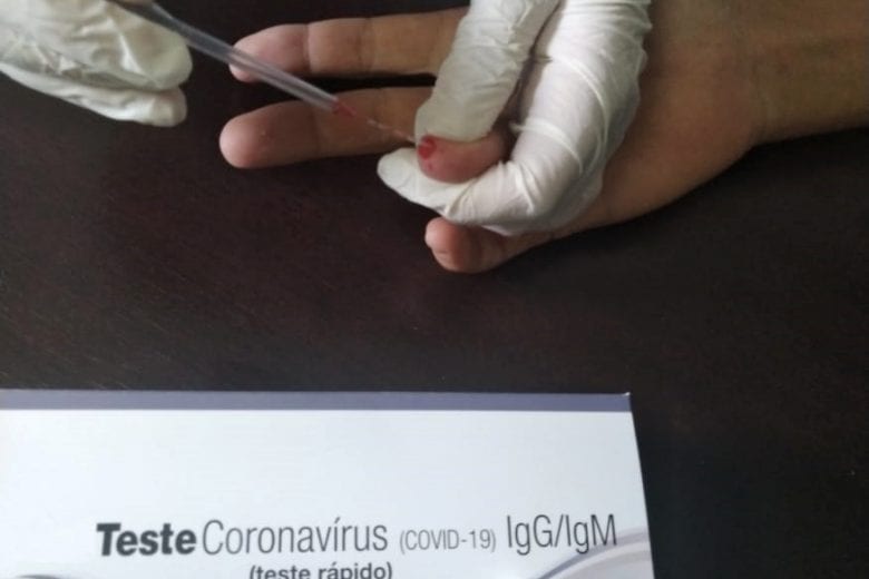Dois de 205 servidores da saúde em Santa Bárbara testam positivo para coronavírus