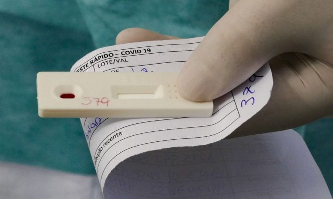 Prefeitura fará testes de Covid-19 na Praça do Povo e Manoel Loureiro neste sábado