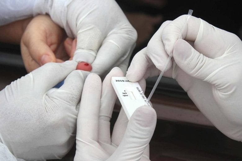 Prefeitura inicia aplicação de 9 mil testes para investigar evolução da covid-19 em Itabira