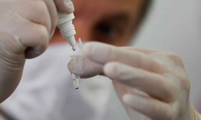 Gripe ou Covid-19? Especialistas ressaltam importância da testagem