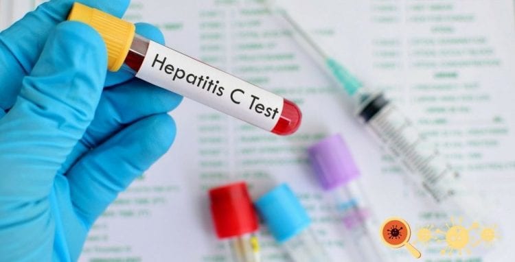 hepatite c