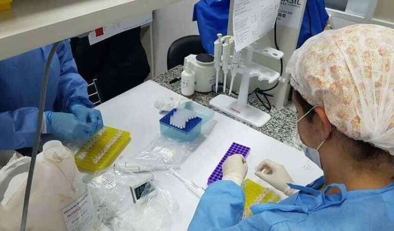 Estudo confirma os perigos de não tomar 2ª dose contra Covid-19