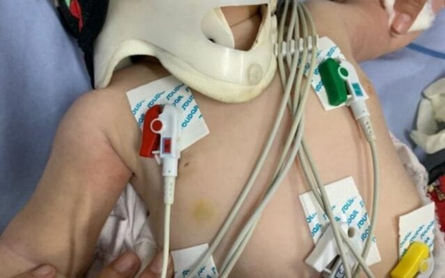 Médica atende bebê com mais de 30 lesões e aciona a polícia