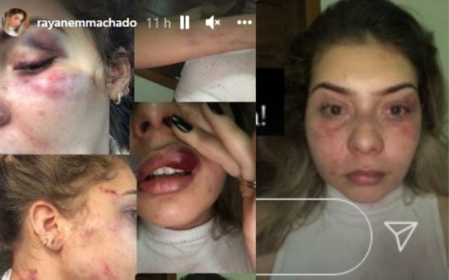 Violência contra mulher: itabirana usa redes sociais para denunciar agressões