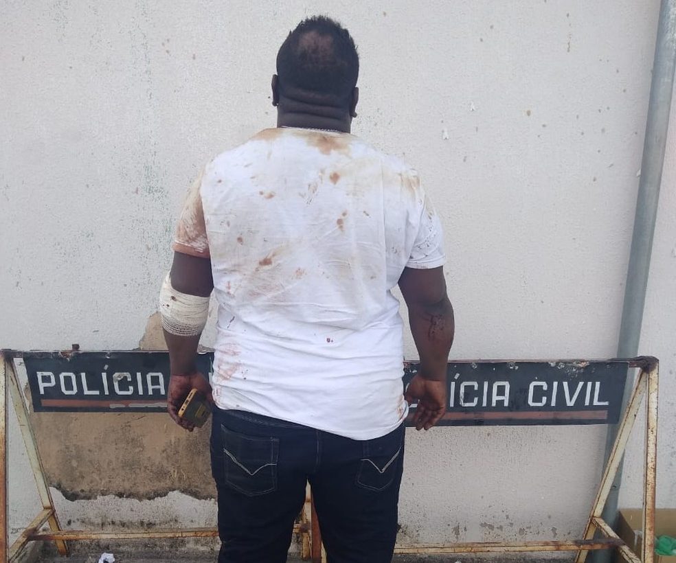 Homem coloca fogo na própria casa, depois esfaqueia companheira e mais cinco pessoas