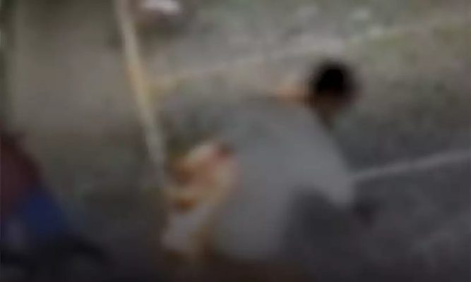 jovem teve 20% do corpo queimado