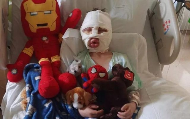 Bullying: garoto de 6 anos é atingido por bola de tênis em chamas