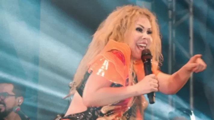Joelma aparece com rosto inchado e preocupa fãs: 'sequelas da Covid'