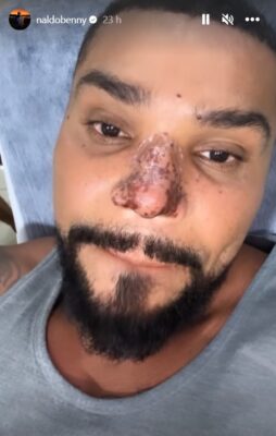 naldo benny