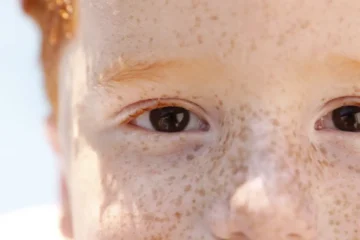 Campanha de conscientização sobre retinoblastoma começa neste sábado