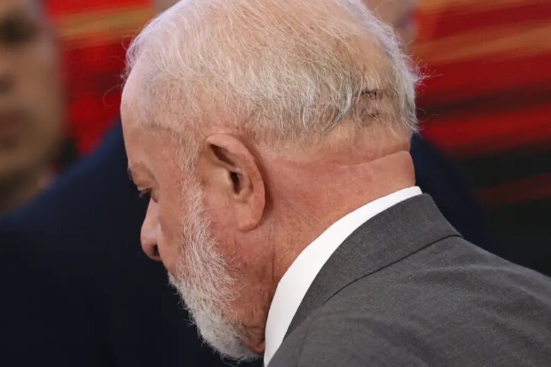 Médico de Lula descarta sequela e diz que função cerebral está intacta