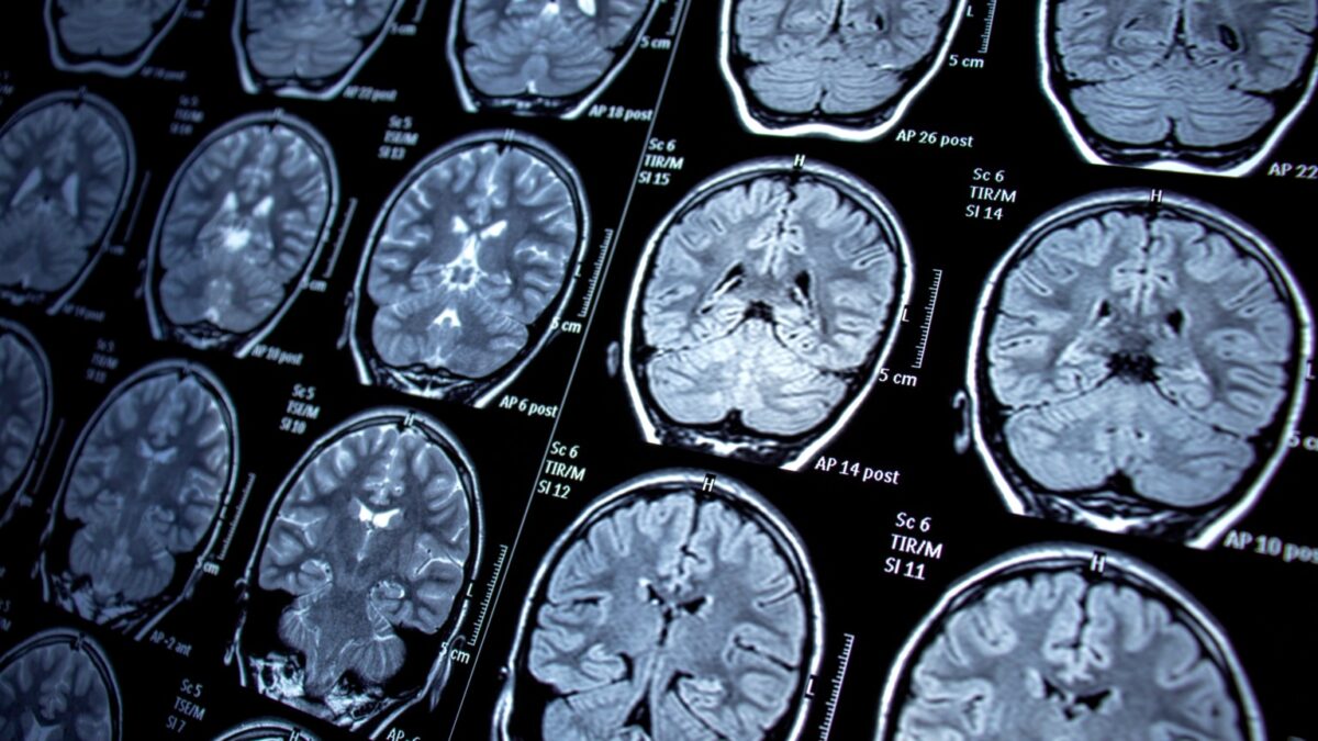 Neurologia