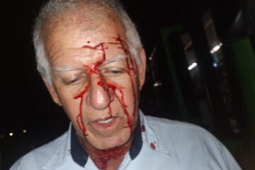 Motorista da Vita é atingido por pedrada no rosto enquanto dirigia em Itabira
