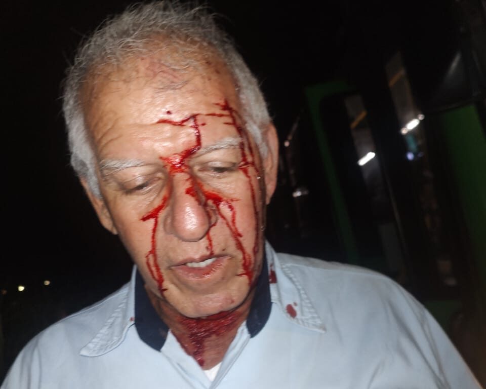 Motorista da Vita é atingido por pedrada no rosto enquanto dirigia em Itabira