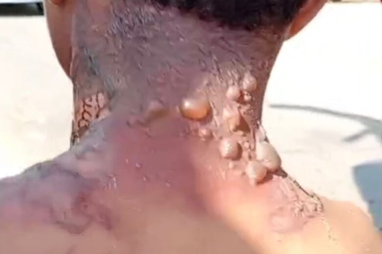 Mulher é procurada após agredir companheiro, lançar água fervendo e mantê-lo trancado em quarto em Itabira