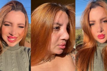 Larissa Rocha relata enfrentamento ao preconceito e inspira pacientes com fissura labiopalatina