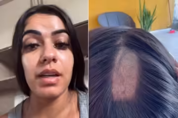 Clínica raspa cabelo de mulher em exame toxicológico para CNH