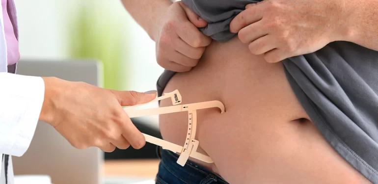 Cirurgia bariátrica: saiba o que é mentira e verdade sobre este assunto