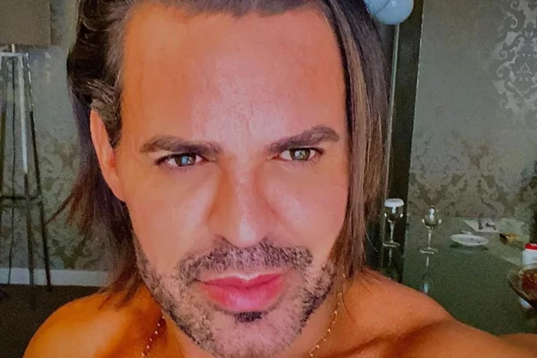 Eduardo Costa assume visual bizarro e fãs debocham: “Tio Chico”