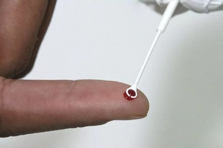 PrEP: conheça o tratamento que é alternativa no combate ao HIV PrEP: conheça o tratamento que é alternativa no combate ao HIV