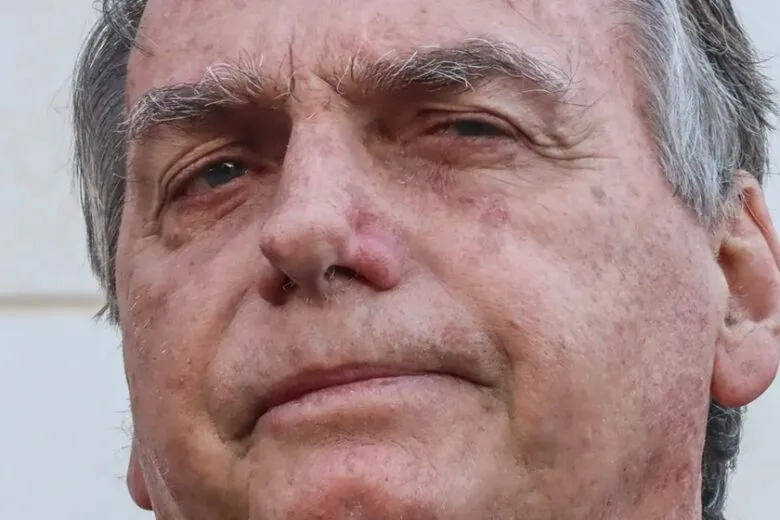 Bolsonaro apresenta piora clínica e vai passar por novos exames