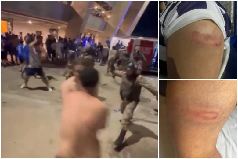 Itabirano denuncia agressões de policiais no Mineirão, após jogo entre Cruzeiro e Flamengo Itabirano denuncia agressões de policiais no Mineirão, após jogo entre Cruzeiro e Flamengo